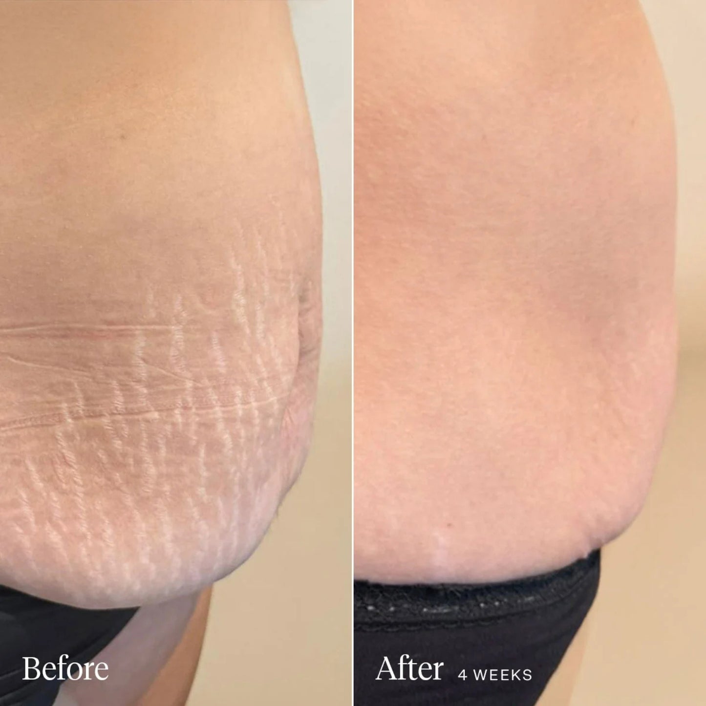 Alternate image of Joonbyrd Daydreamer Body Serum results