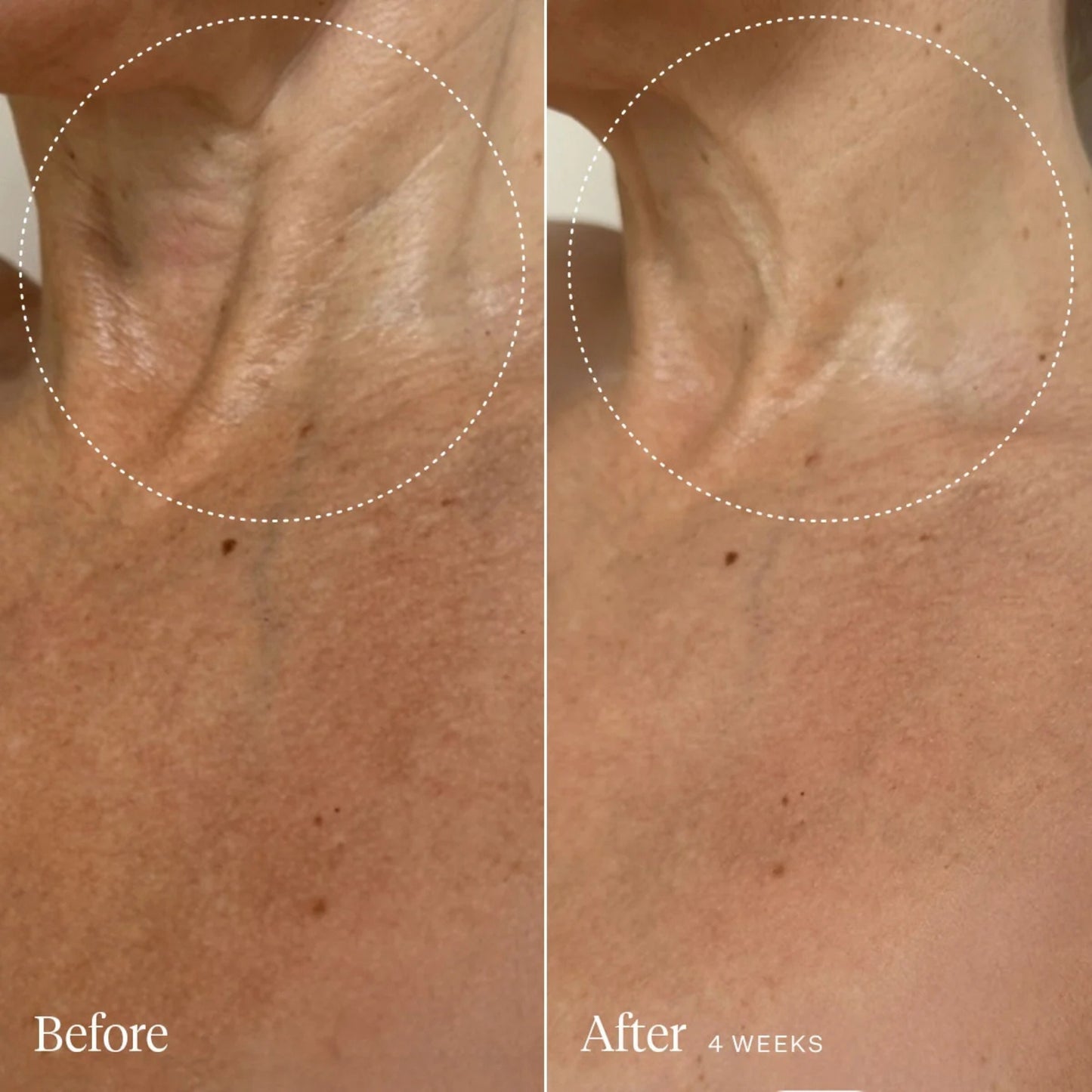 Alternate image of Joonbyrd Daydreamer Body Serum results