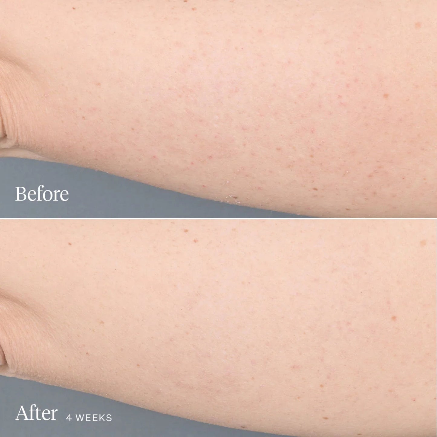 Alternate image of Alternate image of Joonbyrd Kaleidoscope Body Serum results
