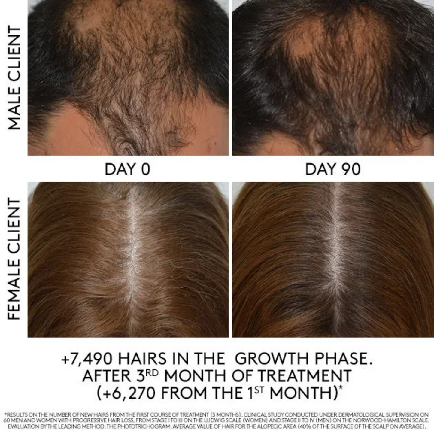 Before and After Image of Rene Furterer Triphasic Progressive Thinning Hair Ritual