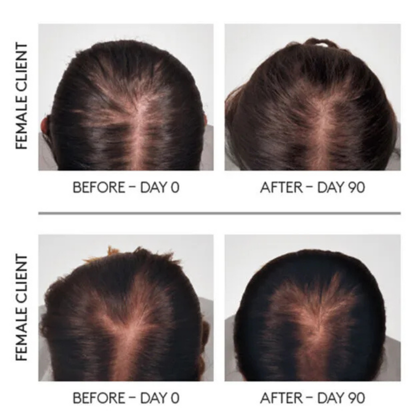 Before and After Image of Rene Furterer Triphasic Progressive Thinning Hair Ritual