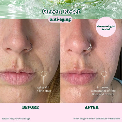 Alternate image of ESW Beauty Evergreen Reset Anti-Aging Sheet Mask results
