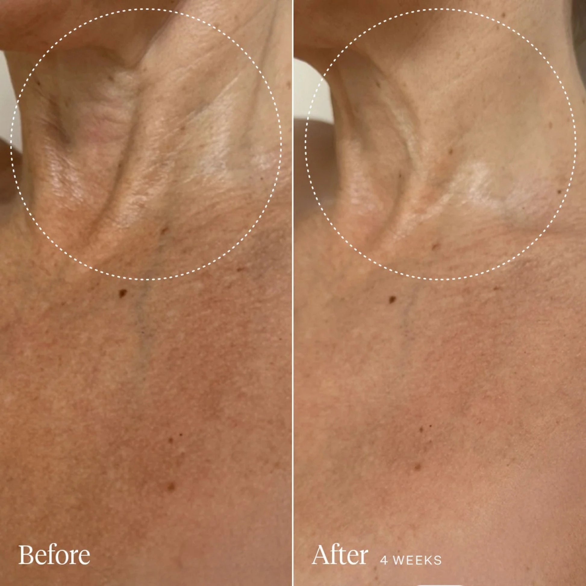 Alternate image of Joonbyrd Daydreamer Body Serum results