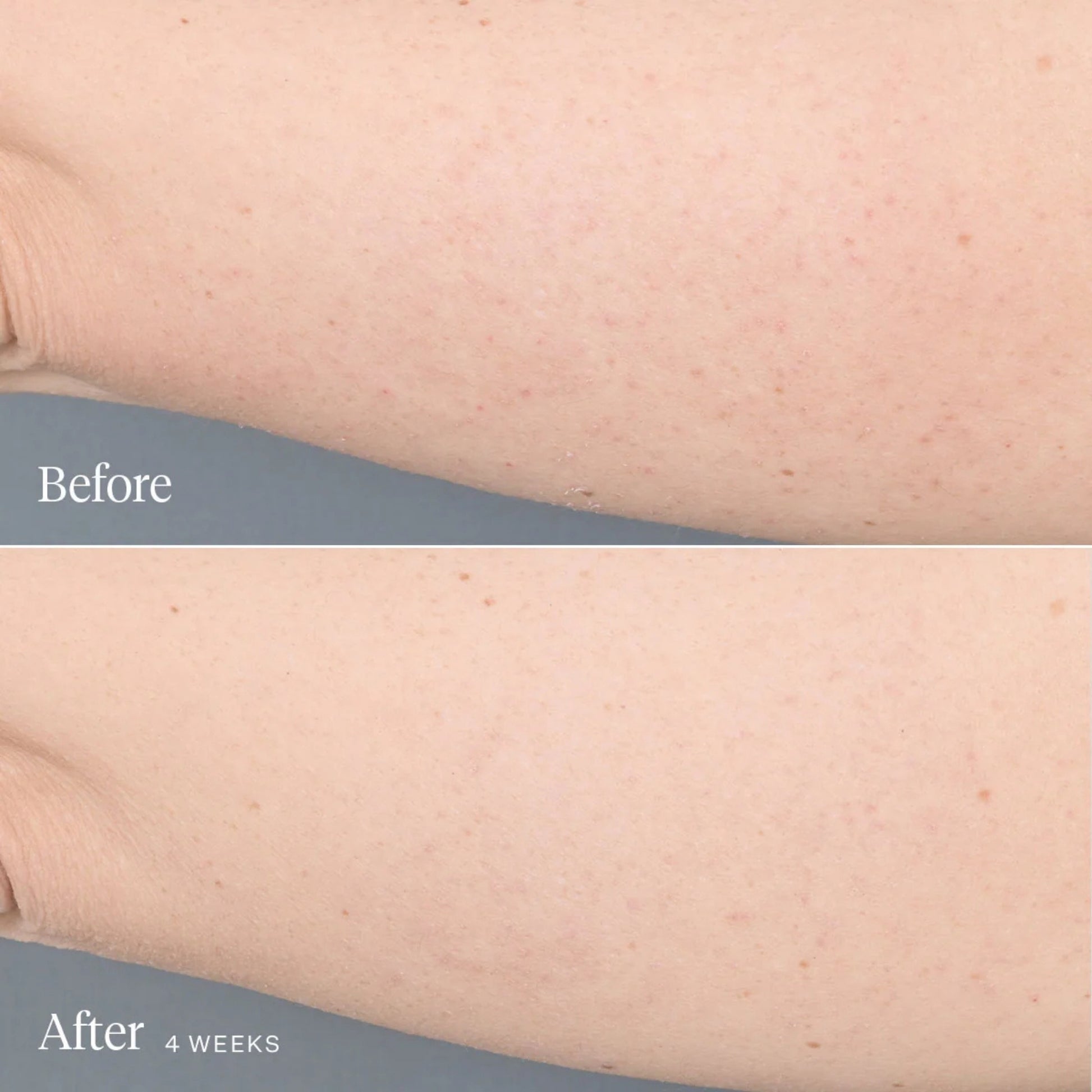 Alternate image of Alternate image of Joonbyrd Kaleidoscope Body Serum results