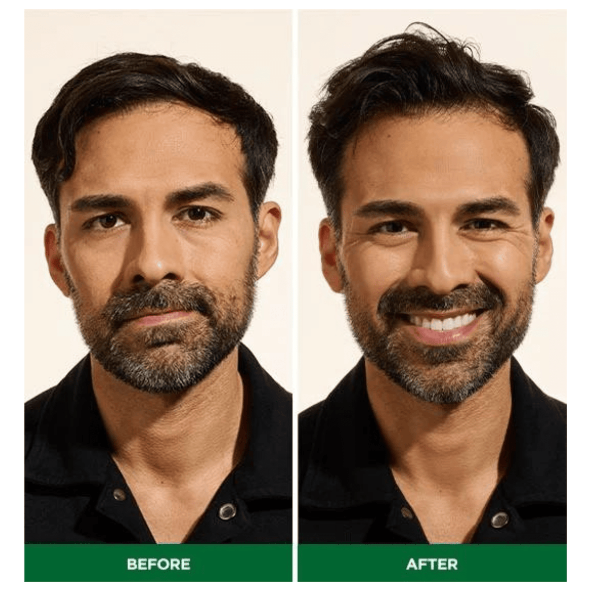 Alternate Image of True Volume Hair Density Foam Before and After 2